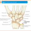 Ulnar Sided Wrist Pain Ocean Orthopedic Associates